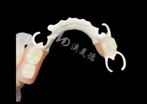 Best Custom Cast Partial Denture with HPP framework for Enhanced Chewing and Speech wholesale