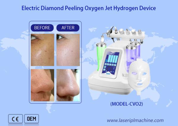 Cheap Home Use 7 In 1 Oxygen Microdermabrasion Machine Facial Beauty for sale