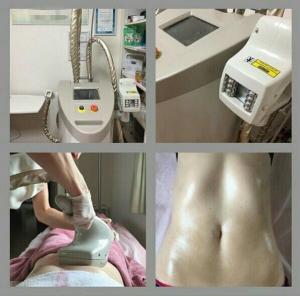 10M Hz RF Frequency Vacuum Slimming Machine With 50mm X 55mmBody Handpiece Treatment Area