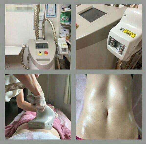 Cheap 10M Hz RF Frequency Vacuum Slimming Machine With 50mm X 55mmBody Handpiece Treatment Area for sale