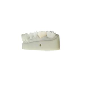China OEM 3D Printed Dental Models CAD CAM Design For Denture Laboratory on sale