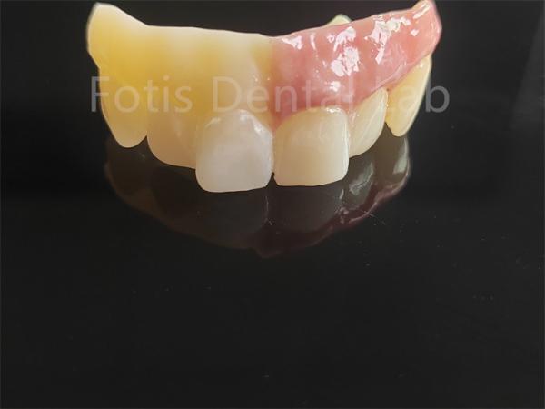 Cheap Monolithic Zirconia Layered With Porcelain Computer Aided Design for sale