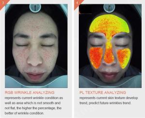 Best Handheld Wireless Wifi 3d Skin Analysis Machine Digital With Video Microscope wholesale
