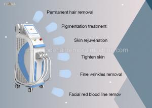 Body Contouring Vacuum Liposuction Machine Rf With Three Tips Customized Color