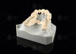Milled Peek Framework Customizable Digital Partial Dentures Superior Thin