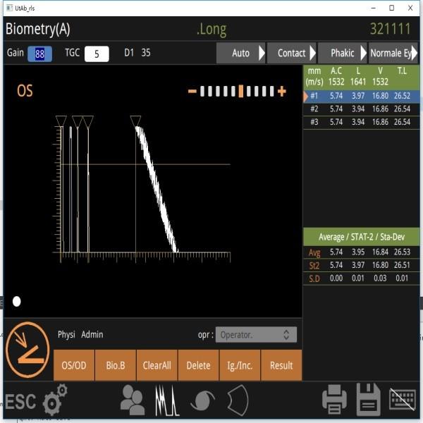 Cheap Fan Scan B Scan Machine 10MHz Observing Retinal Detachment for sale