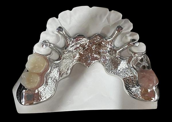 Cheap Customizable Cast Partial Removable Denture With Acrylic Resin / Metal Base Design for sale