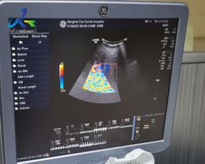 GE Logiq S8 Image Anomaly Ultrasound Machine Repair Replace Channel Board