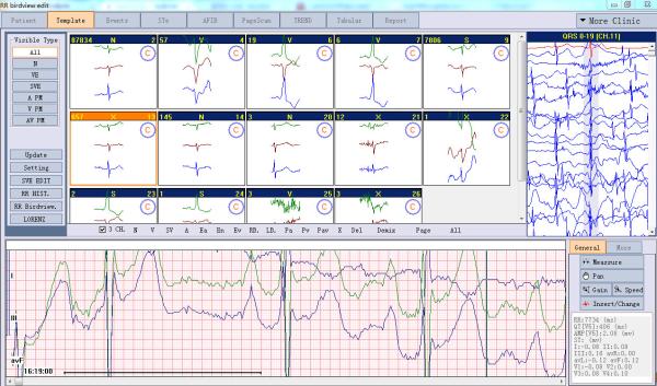 Cheap PC Based ECG Holter Monitoring System 24 Hours Ambulatory Recording iTengo for sale