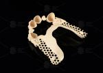 Milled Peek Framework Customizable Digital Partial Dentures Superior Thin
