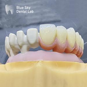 Customize Color Implant Cases with Smooth Surface Nature Design for Universal Compatibility