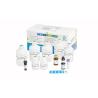 Buy cheap 40T/Kit Sperm Function Test Kit Induced Acrosome Reaction By Calcium Method from wholesalers