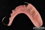 Elaborate Technology For Stable Oral Structure Framework Set Up Teeth Finish In