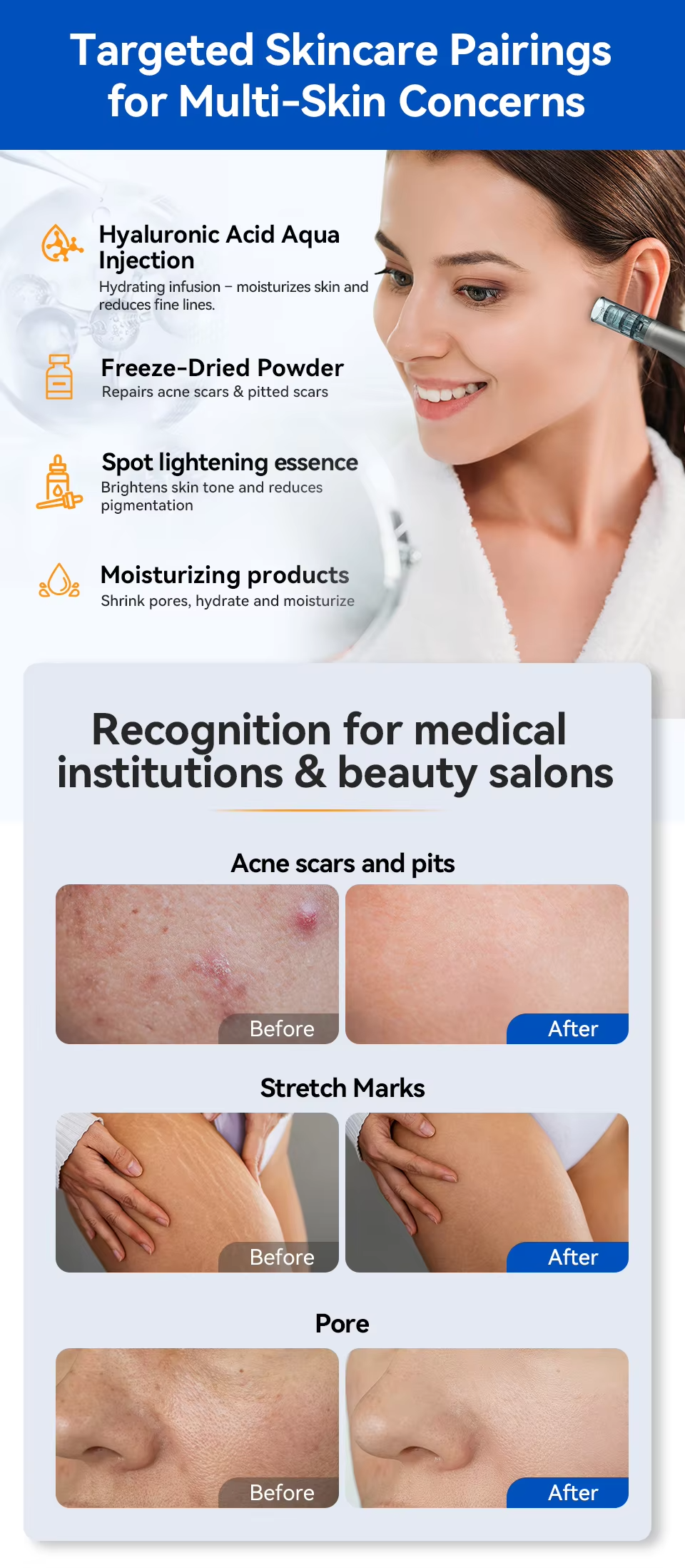 Bio Pen Q2 Derma Pen 3-in-1 Microneedling Pen with LED Light Therapy & Microcurrent for Anti-Aging skin Care