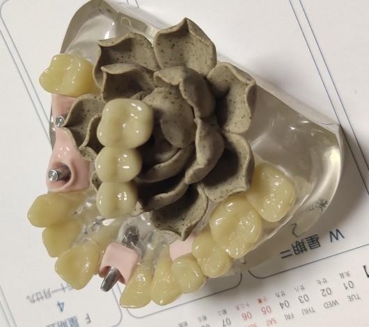 Cheap 100 Percent Biocompatibility PMMA Provisional Crown for sale